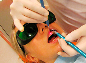 Магнитно-лазерная терапия в стоматологии 